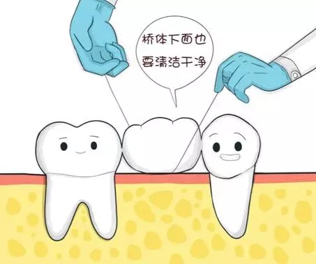 做好假牙的护理，延长假牙使用寿命